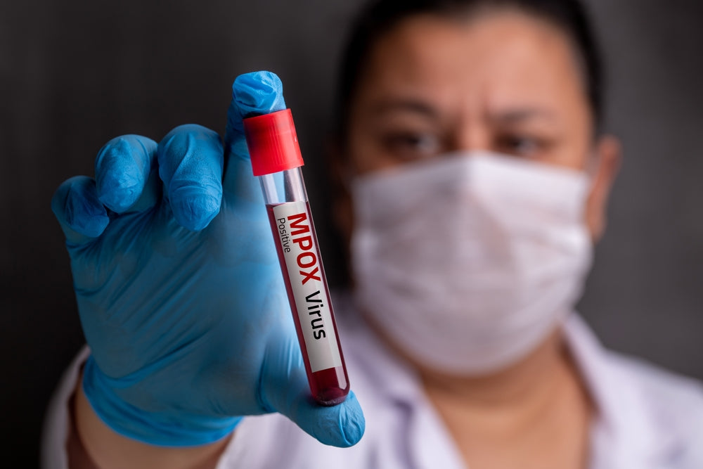 Vet Emergency 2025: Monkeypox in Animals—Risks, Quarantine, and CDC Safety Rules 🐾🦠