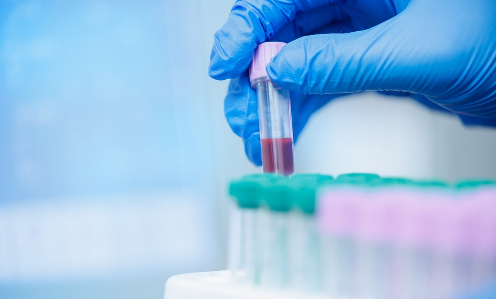 What Blood Work Reveals About Your Pet’s Health